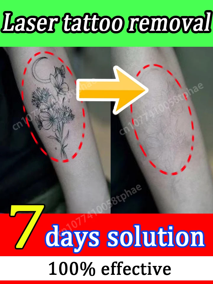 

LP,Wazi-истоaziss,saziazi,TCPs