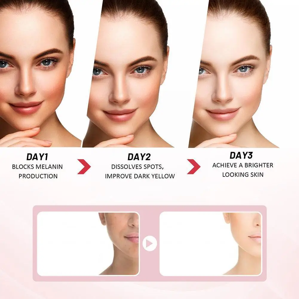 Eelhoe 3 일 코직산 미백 보습 크림, 얼굴 주근깨 다크 크림, 스팟 케어, 브라이트닝 스킨 크림 제거