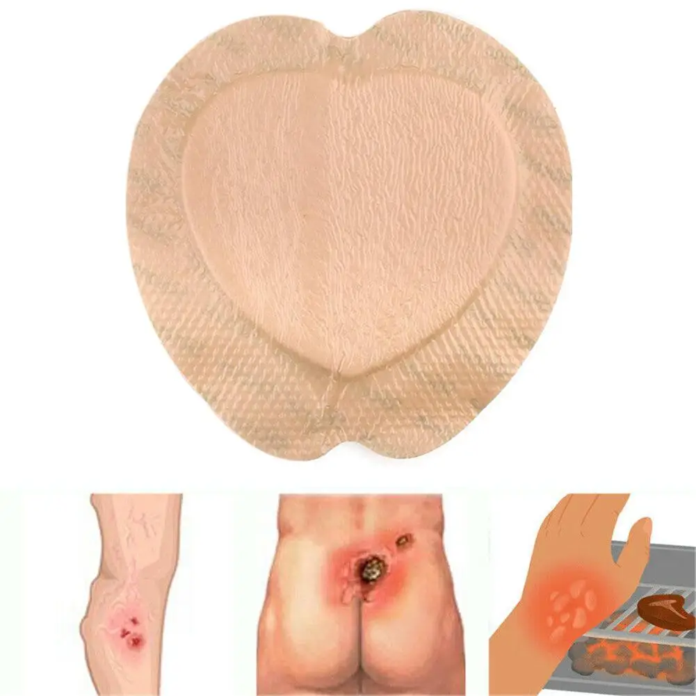 1Pc New Bedsore Healing Pad Thin Soft Ulcer Healing Acne Patch Hydrocolloid Adhesive Wound Dressing Breathable Sweat Resistant
