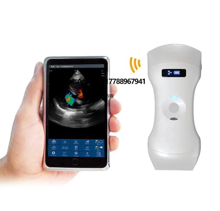 

MC26 192 Elements Elegant White 3 in 1 Wireless Ultrasound Probe Medical Usg Scanner with Good Price