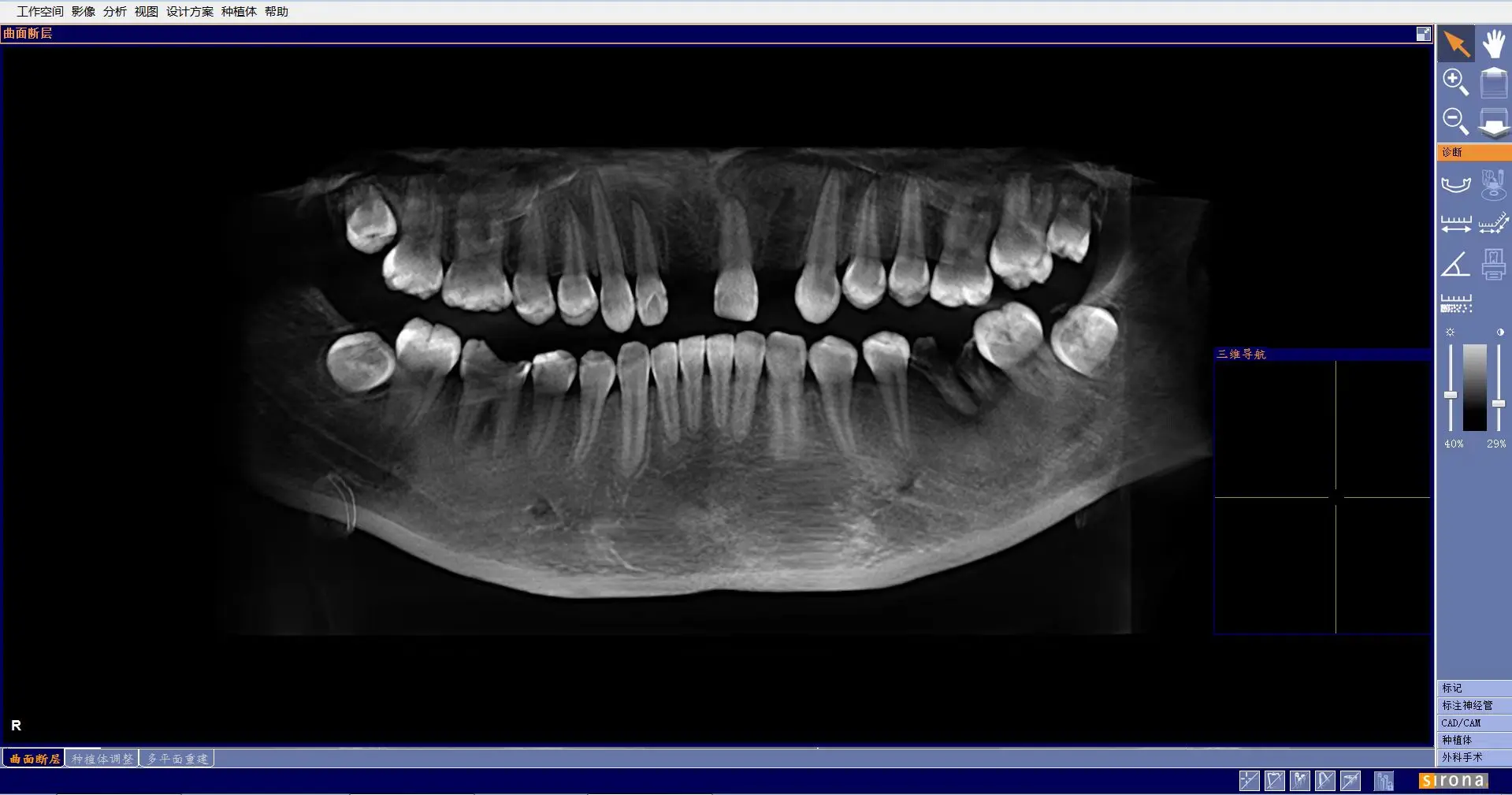 جهاز Orthophos XG 3D الماسح الضوئي الرقمي الب্যানোরামিক X Ray CBCT بسعر جيد