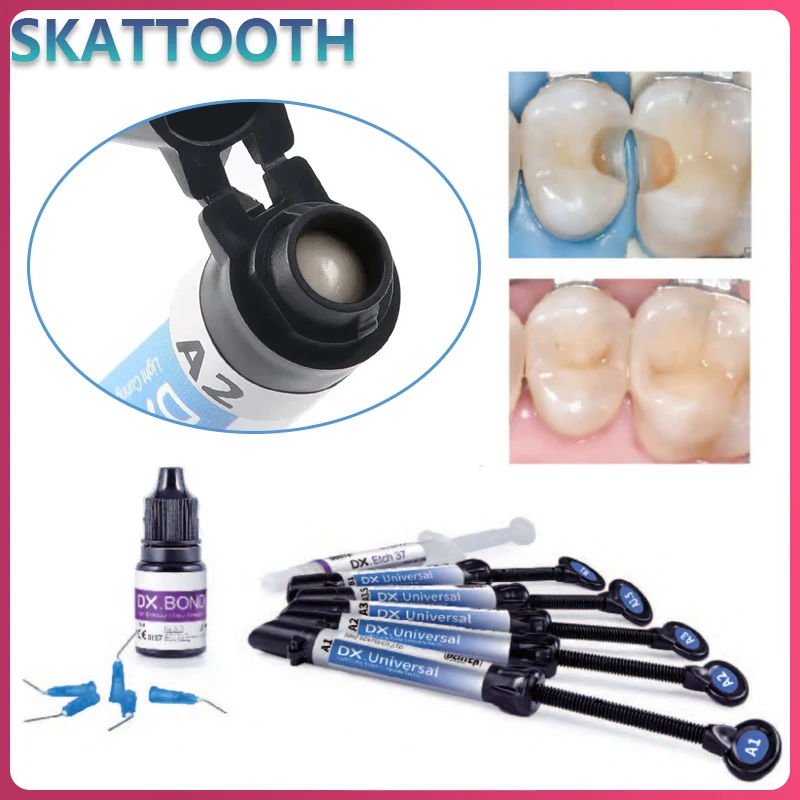 

Dental Light-Curing Resin DX Universal /Acid Etching Gel /Light Cure Bonding Adhesive /Acid Etching Gel Kit Composite Resin