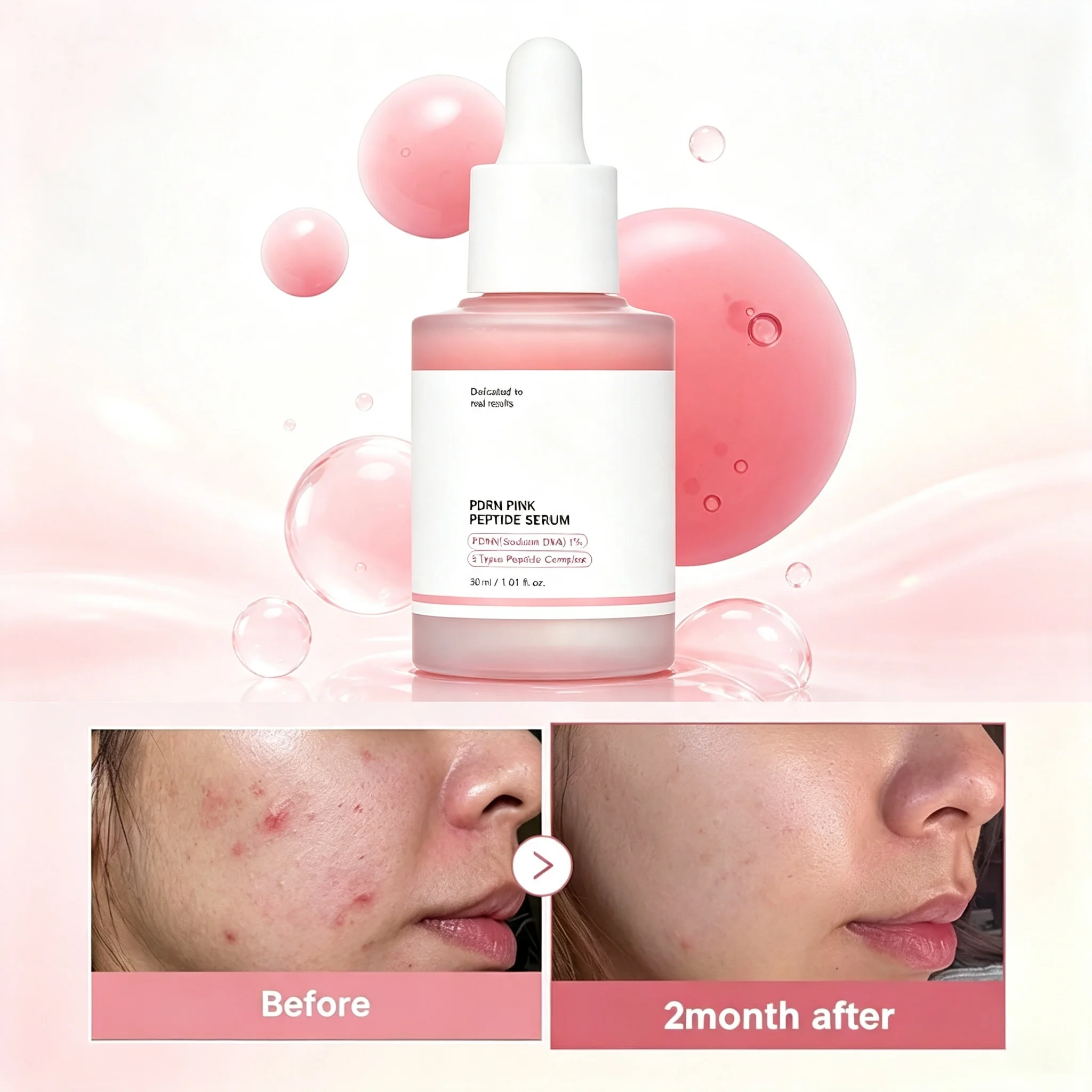 Pink Peptide PDRN essence, Glass Luster, Reduce Black Spots, Skin Repair, Salmon PDRN, Korean beauty Products