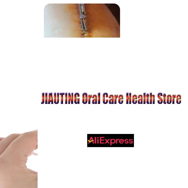 

1 Pcs White Disposable Skin Stapler Nails Clipper Surgical Skin Suture Nails Remove Tool Stainless Steel+Plastic Nail Puller