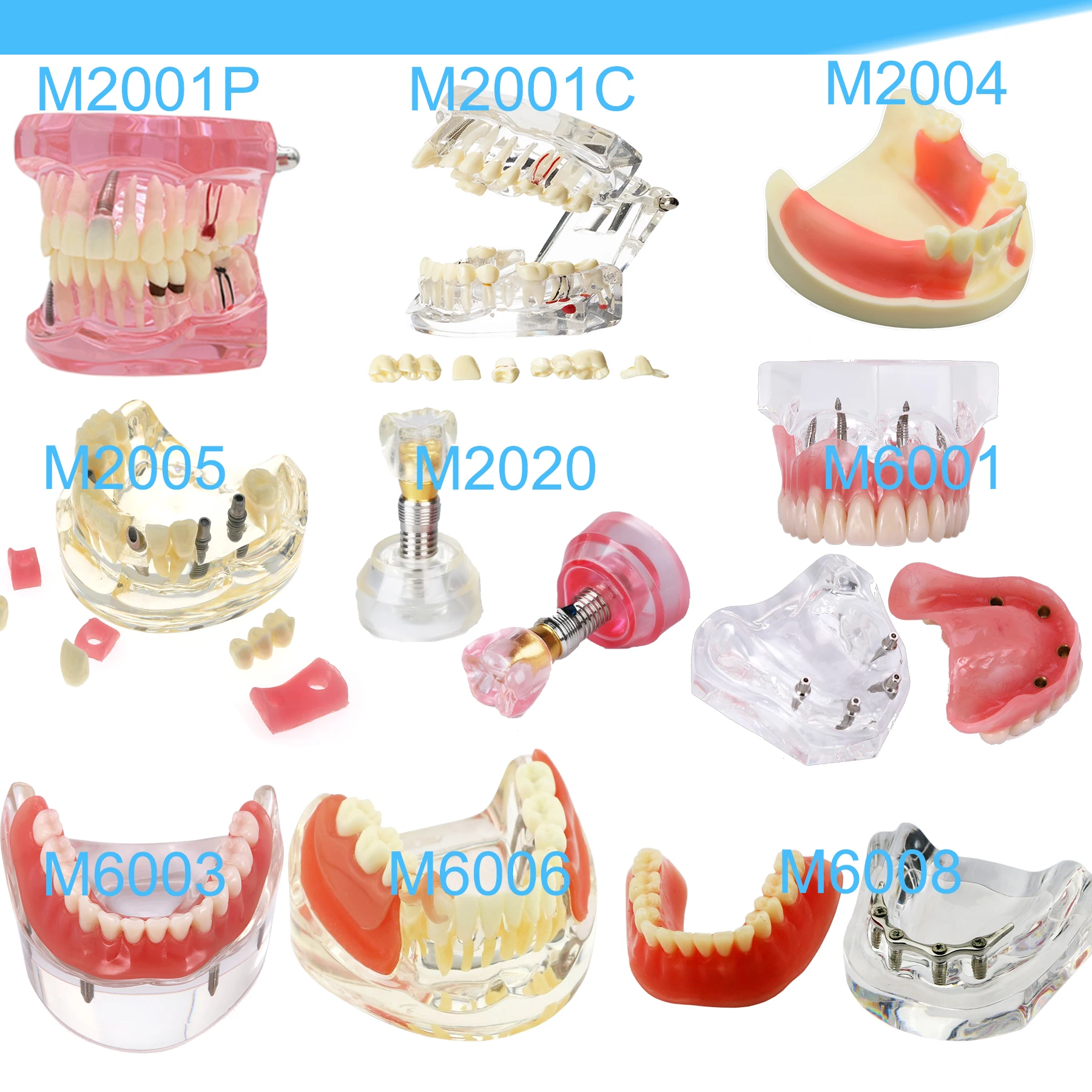 Modèle de dents dentaires, fuchsia, implants standard, orthodontique, dentiste, démonstration, étude