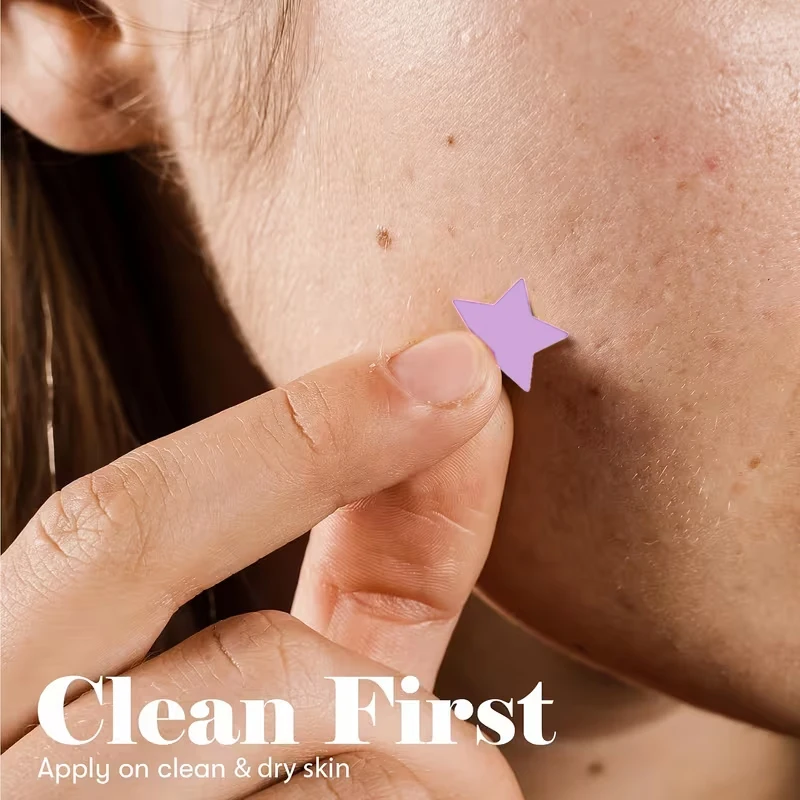 840 Pieces of Colorful Star-Shaped Hydrocolloid Acne Patches, Facial Stickers, Facial Decorations, Gentle and Non-Irritating, Effectively Absorbs Acne Secretions and Surface Oils, Thin and Adheres Without Irritating the Skin Barrier, Invisible and Covers Facial Blemishes, Dopamine Fashion, Available in Various Colors and Sizes to Meet Daily Needs