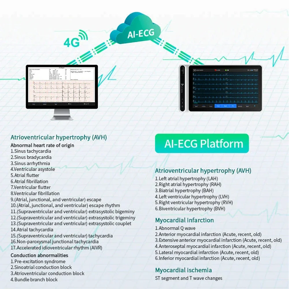 Handheld AI 12 Channels ECG Tablet Chargeable 12 Lead EKG Machine 7\'\' Inch Touch Screen for Clinics Hospitals