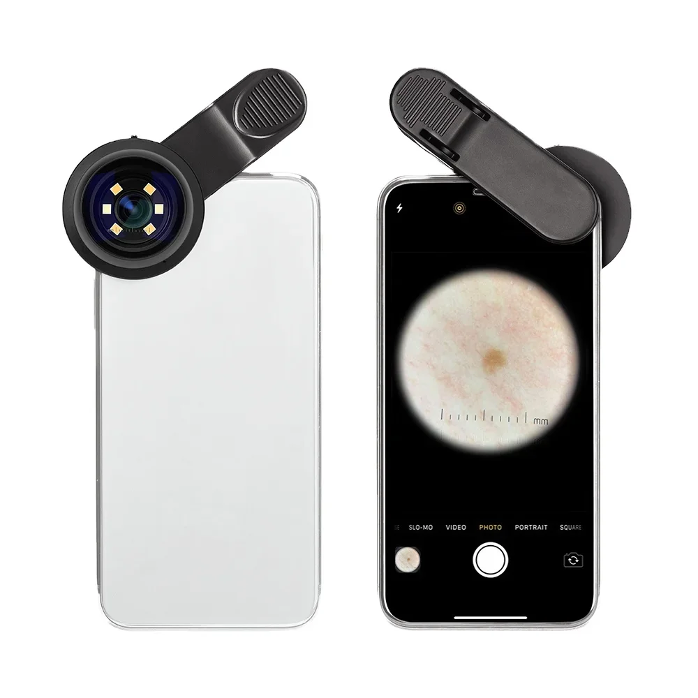 IBOOLO DE-300 Home Use Dermatoscope Smartphone Adapter Medical Dermoscopy Dermatoscopio Digital