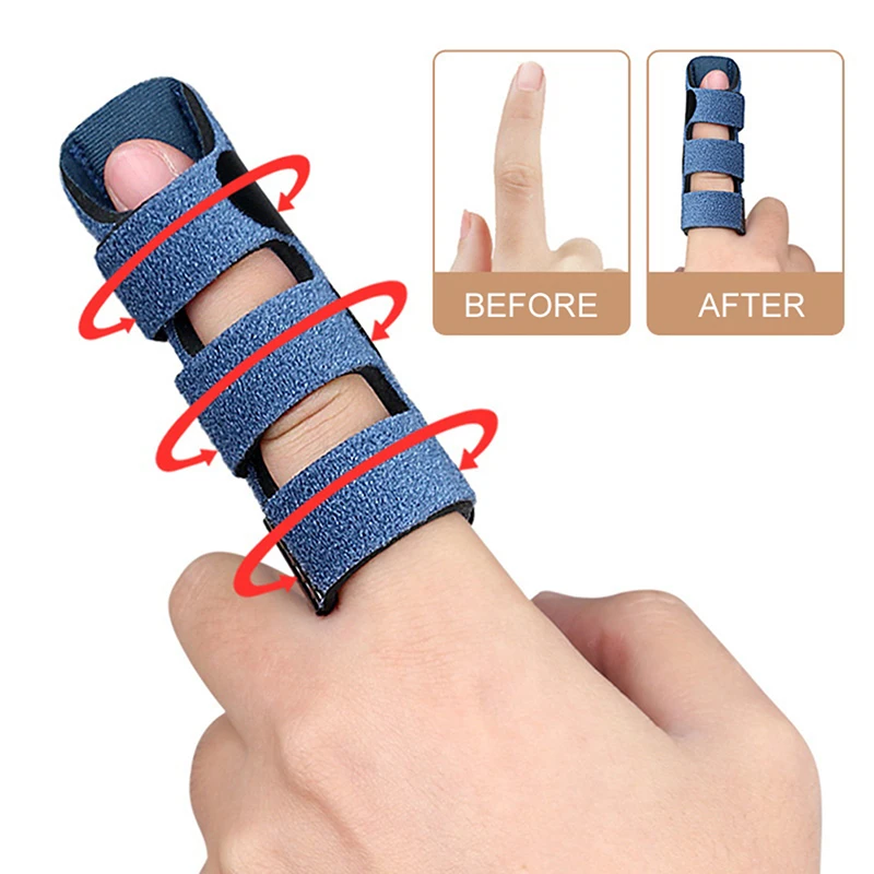 1Pc Verstelbare Vinger Corrector Spalk Pijnverlichting Vinger Brace Ondersteuning Hand Spalk Fix Strap Protector Voor Artritis Gewricht