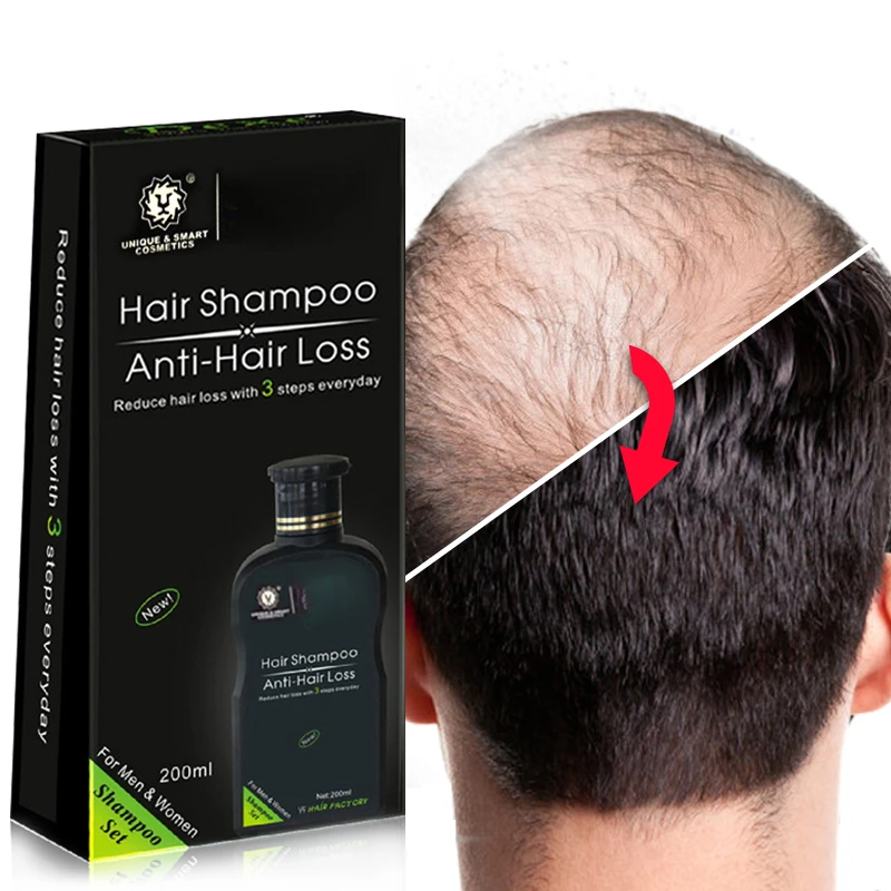 

200ml Hair Anti hair loss Shampoo Chinese Herbal Hair Growth Product Prevent Hair Treatment For Men & Women free shipping