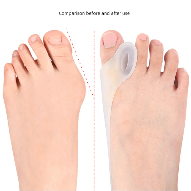 1Piece Big Toe Hallux Valgus Corrector Belt Recovery Training Exerciser Strap Toe Separator Silicone Gel Stretcher Separators