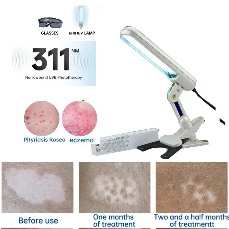 

Original 311nm UVB Phototherapy For Vitiligo, Eczema, Psoriasis, UVB Lamp, Skin Problem Treatment Lamp