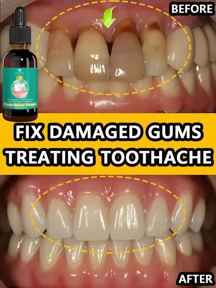 

Effectively repair damaged gums, relieve toothache, strengthen gums, hot sale