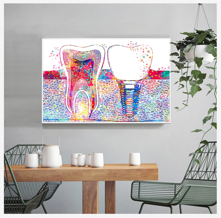 Wall Art Painting Medicine Hygienist Poster Tooth Watercolor Clinic Decor Dental Art Picture Tooth Implant Canvas Print Dentist