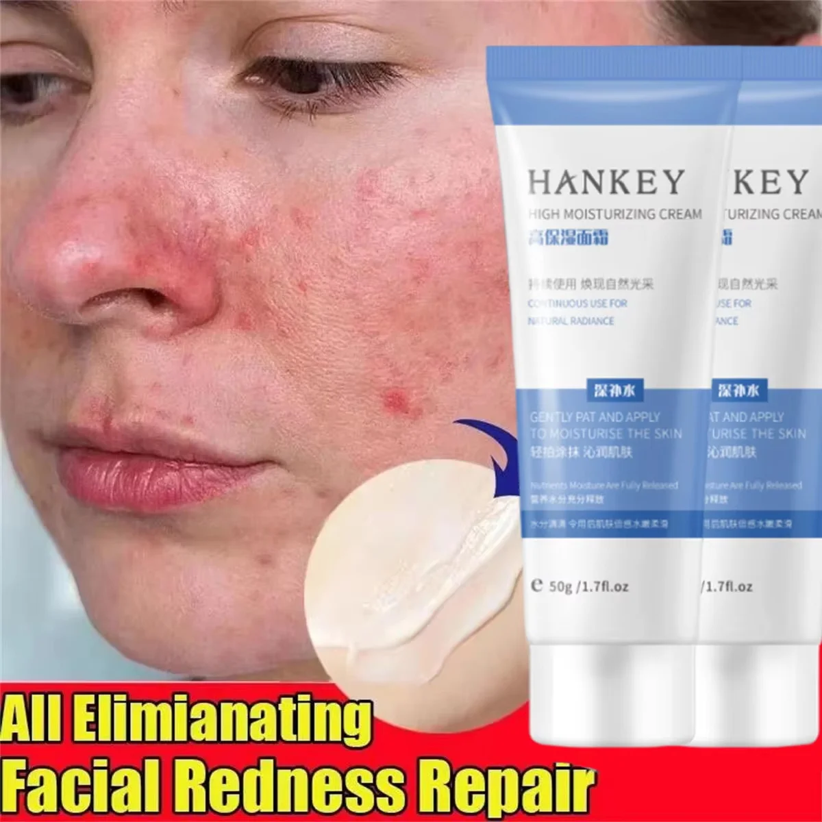 Facial Redness Repair Cream Improve Sensitive Skin Moisturizer Hydrate Sooth Lotion Removal Rosacea Spider Vein Korean Cosmetic