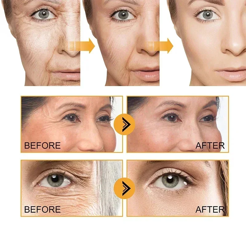 Sofortiges Faltenentferner-Gesichtsserum, Anti-Aging-Lifting, Straffung, Verblassen feiner Linien, Verbessert die Stumpfheit der Haut, Befeuchtung der koreanischen Kosmetik