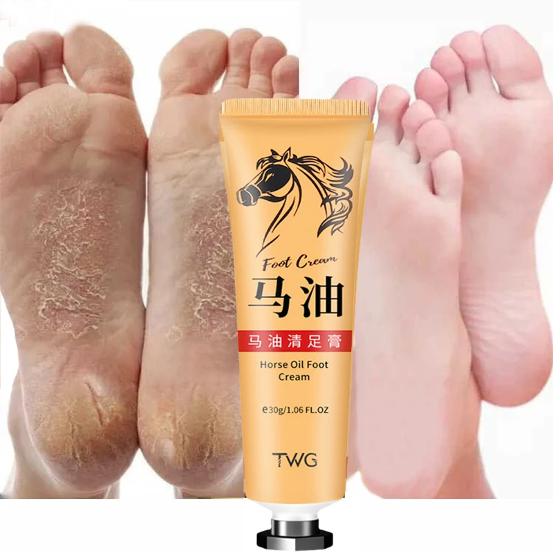 Crema exfoliante para pies con aceite de caballo, hidratante, blanqueadora, nutre la crema de manos, cuidado de los pies, CALLOS, piel muerta, 30g