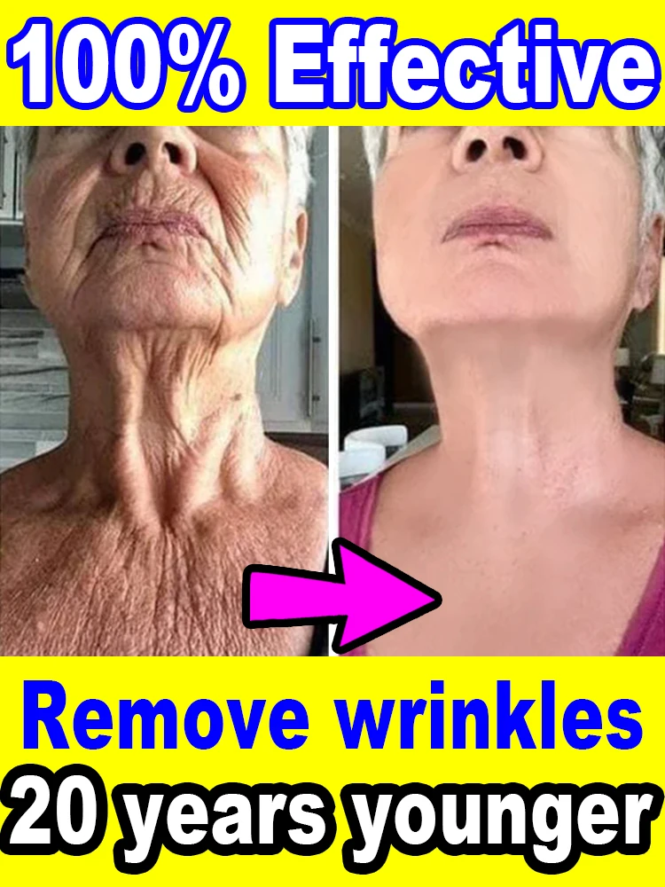 

Wrinkles disappear