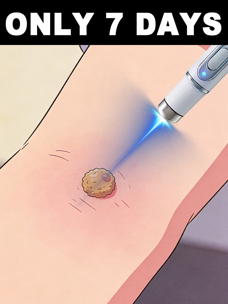 

Recurring warts Address the root cause ᵃⁿᵈ ˢᵃʸ ᵍᵒᵒᵈᵇʸᵉ ᵗᵒ ᵗʰⁱˢ ᵖʳᵒᵇˡᵉᵐ‧