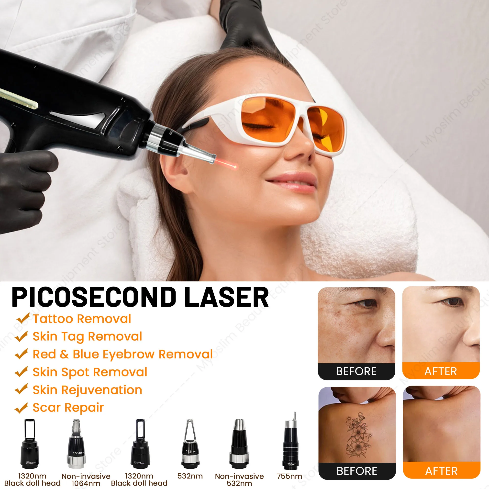 Professional 16 Bars Fac Diode Laser Hair Removal Device 755 Pico Nd Yag Q Switch 6 Wavelengths 755 940 1064 808 810 830nm