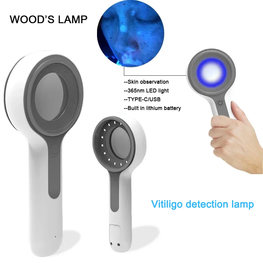 Dermatoscope Skin Medical Magnifier Detection Woods Lamp  UVA Lamp For Vitiligo Detection