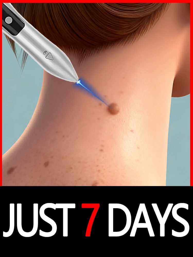 

ᵂᵃʳᵗ ʳᵉᵐᵒᵛᵃˡ ˡᵃˢᵉʳ ᵖᵒⁱⁿᵗᵉʳ 2025 New Upgrade blue light pen set