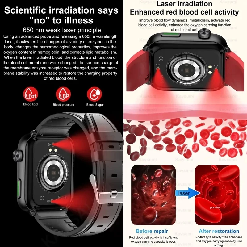 New For HUAWEI Xiaomi Medical Grade Laser Therapy Smartwatch Blood Glucose Blood Lipid Bracelet Bluetooth Call Health Smart Watc