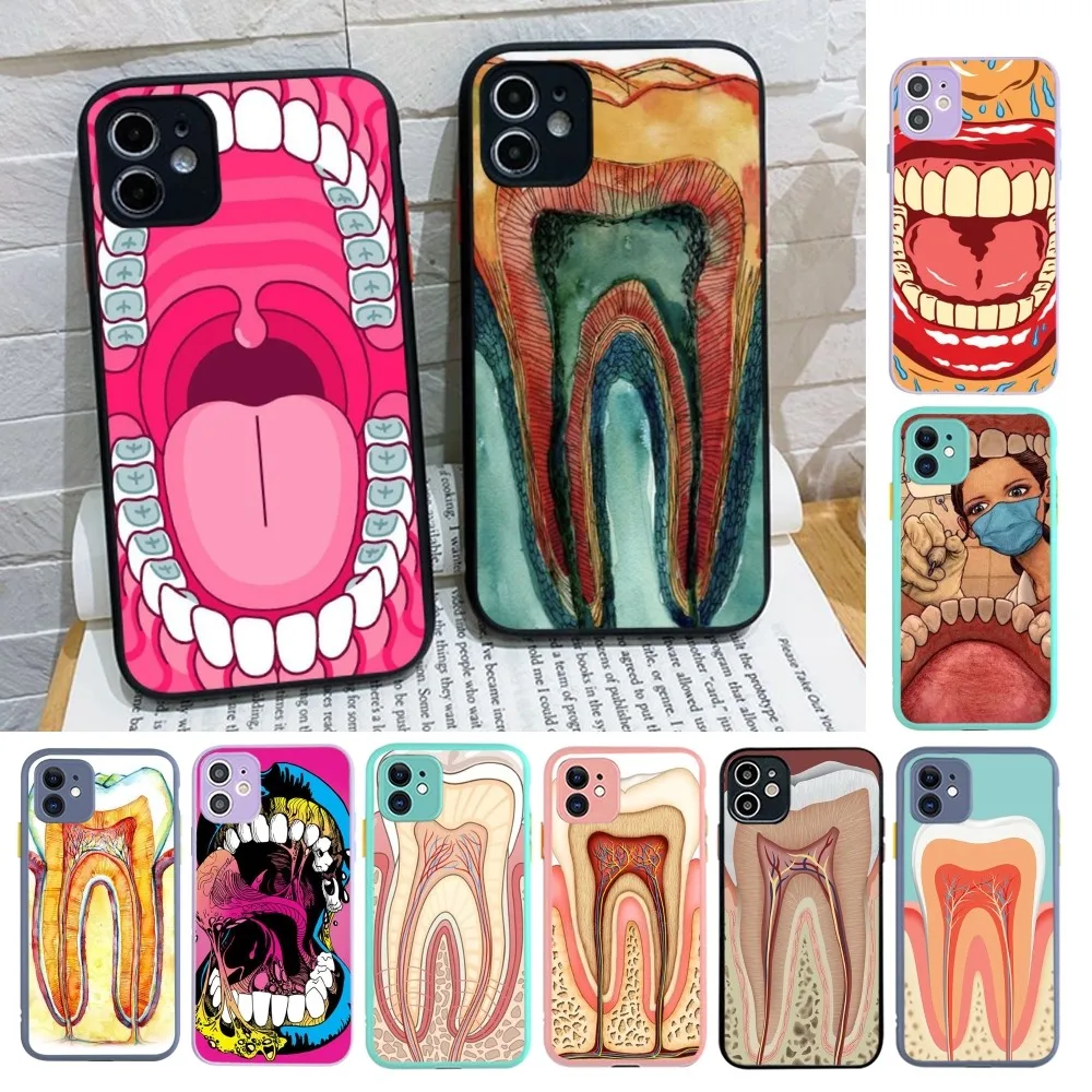 

Wisdom Teeth Dentist Tooth Phone Case for iPhone 14 11 12 13 Mini Pro Max 8 7 Plus X XR XS MAX Translucent Matte Cover