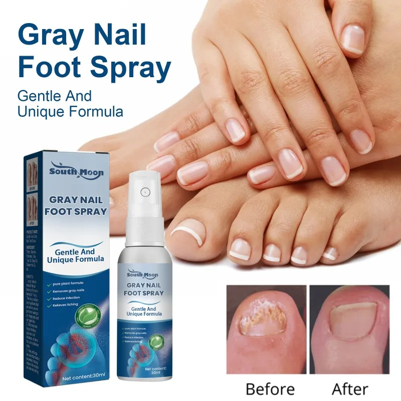 Nail Repair Spray Cleans Odor Repairs Onychomycosis Hand and Foot Soft Nails Thickens Nails Brightens Nails Beauty Health Care