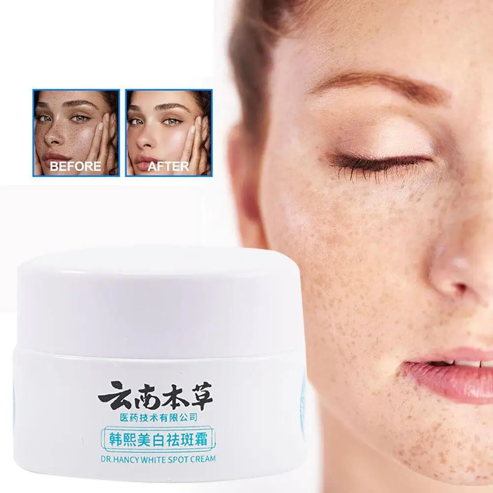 Yunnan-Creme Clareador Facial, Remover Manchas Escuras, Pigmentação, Melasma, Hidratante, Clareamento, Cuidados com a Pele, 20g