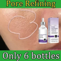 Skin Texture | Pore Refining Resurfacing, Brightening Facial Serum with Retinol and Niacinamide Non-Comedogenic