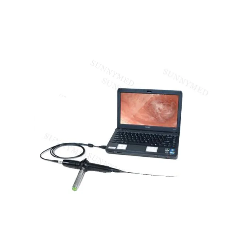 P036 Portable video flexible pet vet veterinary endoscope bronchoscope for small animal dog cat 1.2 mm working channel 3.0mm ENT