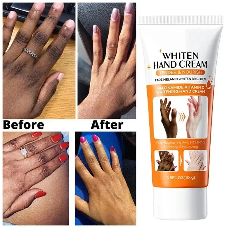 2024 Dark Knuckles Fast Brightening Serum Anti Cracking Cream Pigmentation Correctors For Black Skin Fast Stains Remover Product