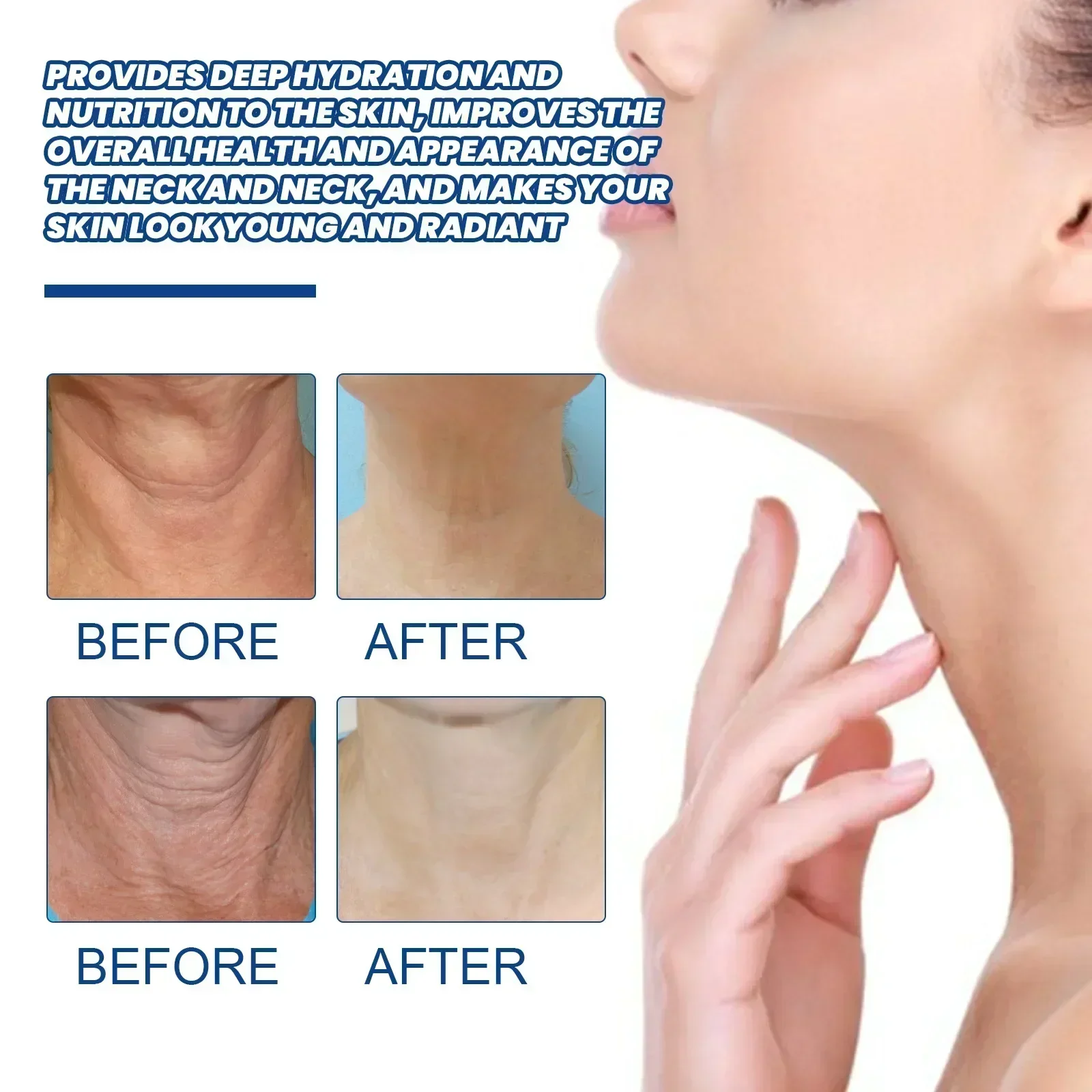 Neck Lines Protein Cream, Chin Duplo, Elimine Moisturis, Nourish, Lift, Elimine Linhas Finas, Anti-Envelhecimento, Rejuvenescimento