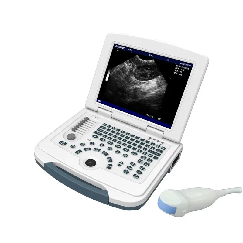 Veterinary B-ultrasound Machine Full Digital Ultrasound Diagnostic Instrument Pet Cat and Dog Ultrasound Machine