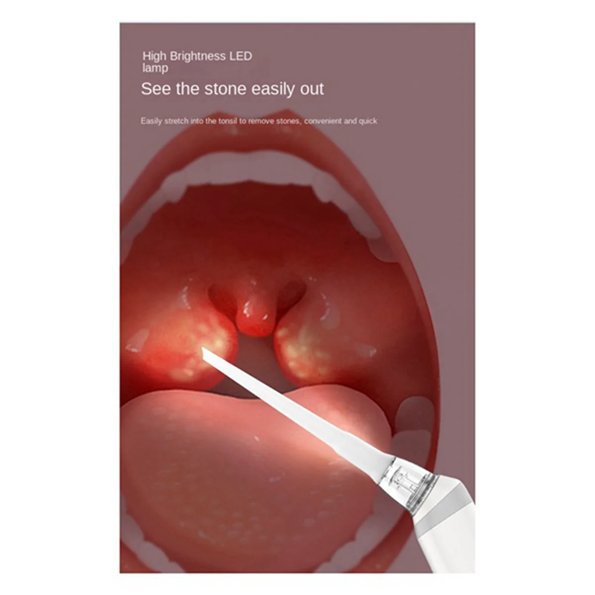 

Y59AElectronic Tonsil Stone Removal Kit,Tonsil Stone Remover Vacuum,Automatic Oral Care Mouth Cleaner,Tonsil Cleaner