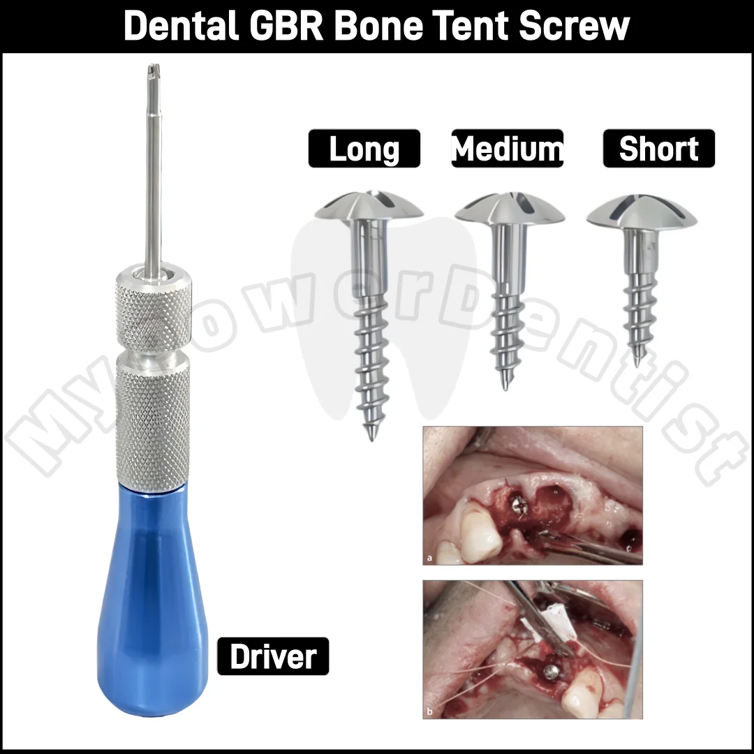Dental GBR Thread Tent Screw Guid Bone Regeneration Membrane Tenting Screwdriver