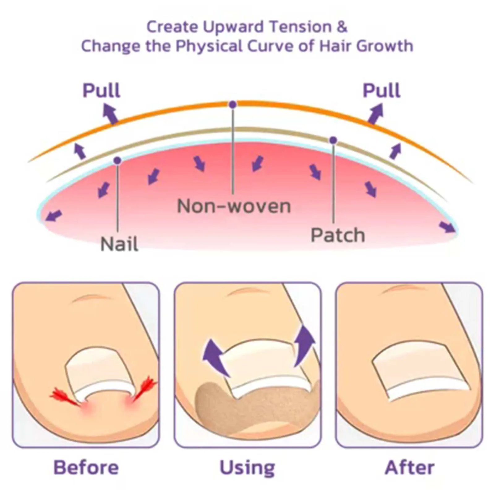 60pcs/box Toe Nail Treatment Patches Breathable Nail Correction Stickers Ingrown Toenail Care Paronychia Painless Repair Patches