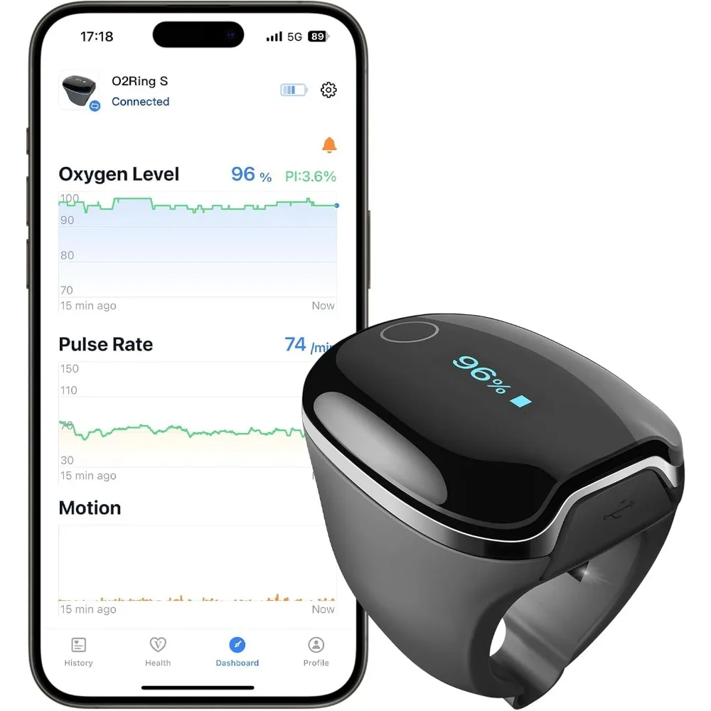 Oxygen Monitor with Vibration Reminder, Bluetooth Pulse Oximeter Tracks SPO2 and Pulse Rate, 24 hrs Battery Life