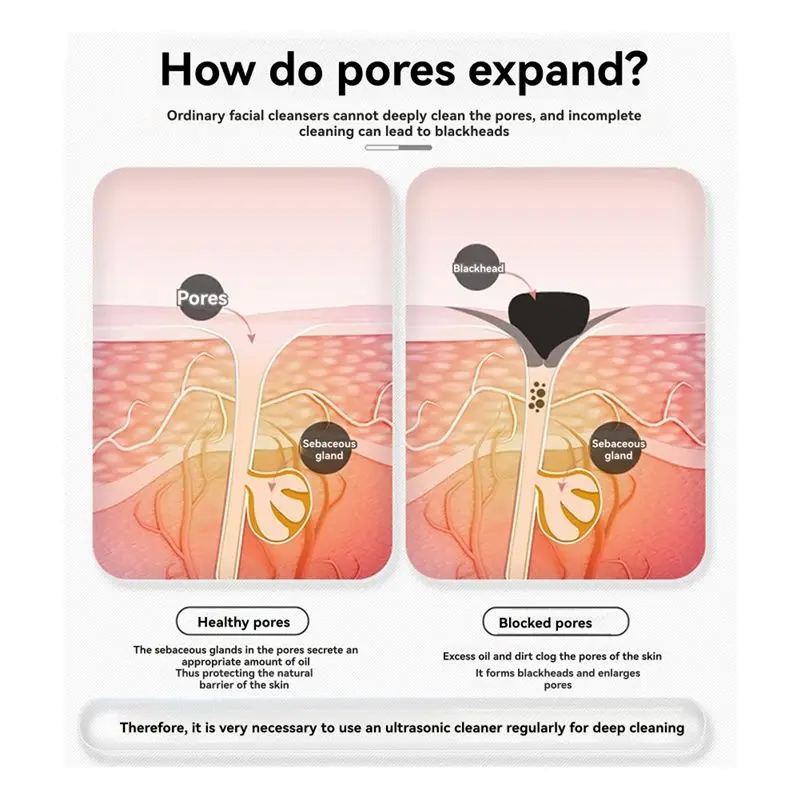 جهاز التجميل، ملعقة تنظيف عميقة للوجه والوجه وإزالة الرؤوس البيضاء #2