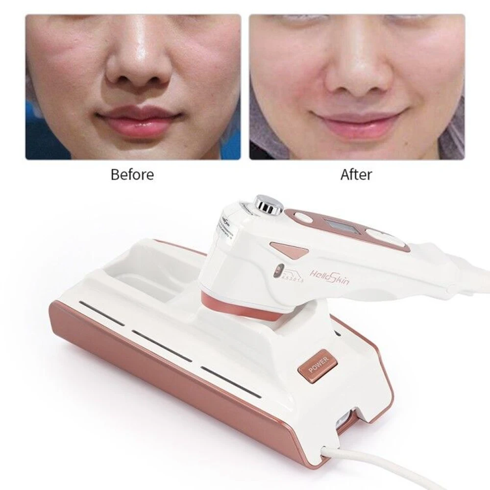 New Focused Beauty Machine Mini Hifu Therapy Skin Tightening Facial Lifting Delicate Skin Whitening Device Anti Wrinkle Aging