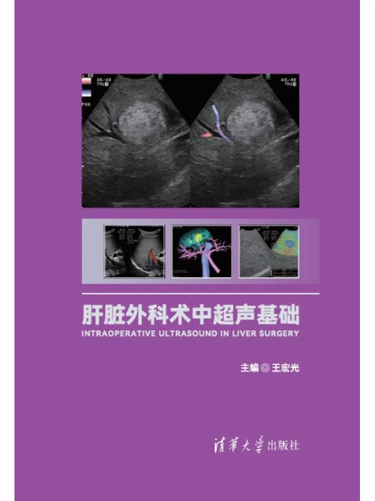 Book-Winshare Basics Of Ultrasound in Liver Surgery