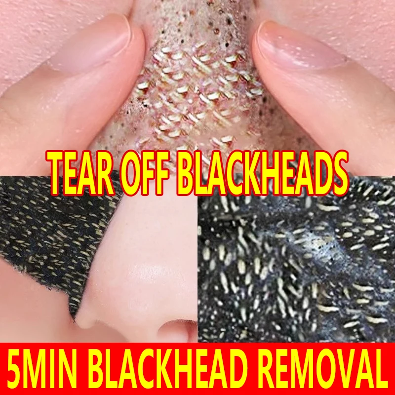 

Blackhead and nose patch peel-off mask for shrinking pores and acne, a nose mud mask specially designed for men and women
