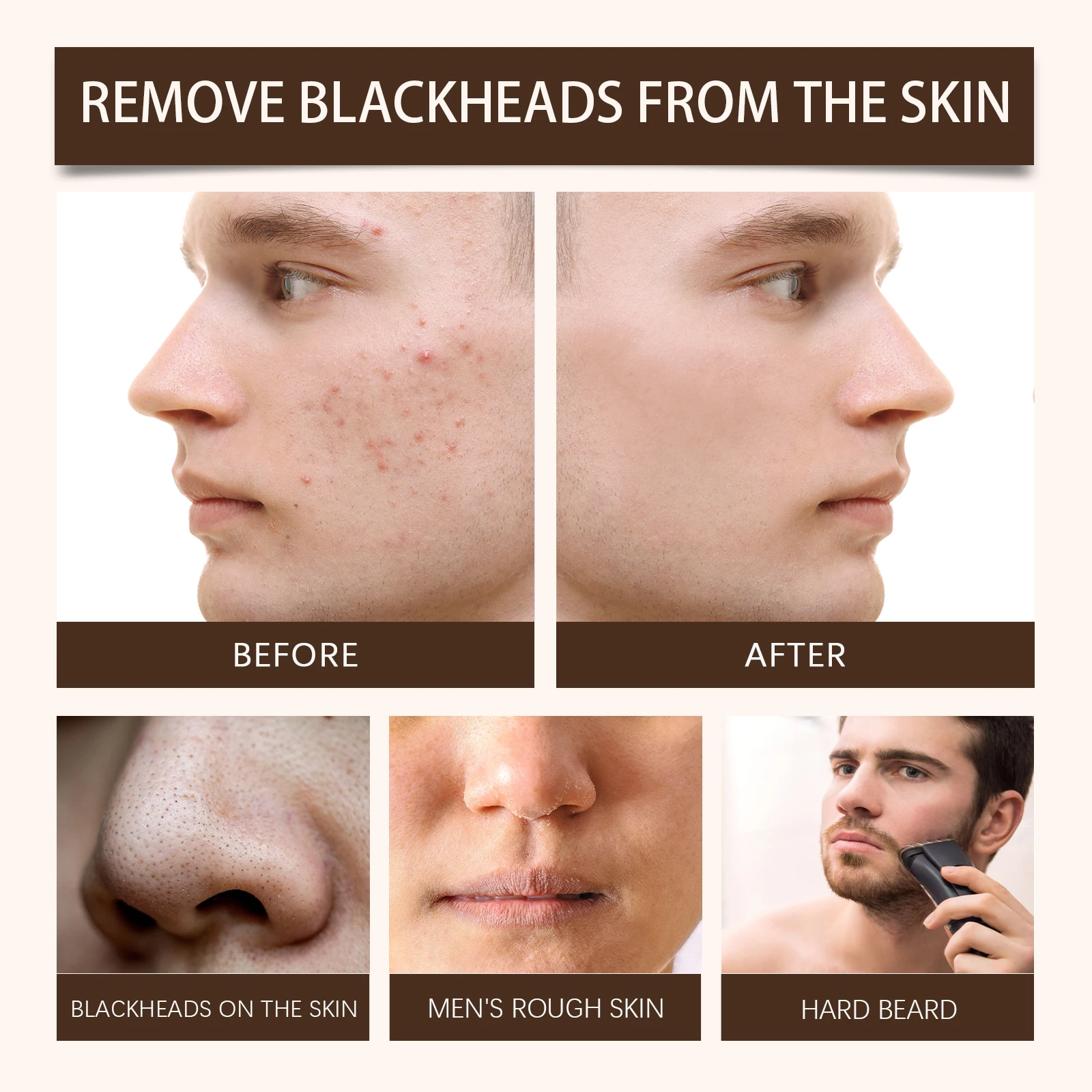 Kaffee-Peeling-Peeling, peelt sanft, um die Poren zu entstopfen, reduziert Mitesser und hellt die Haut für eine glatte Oberfläche auf