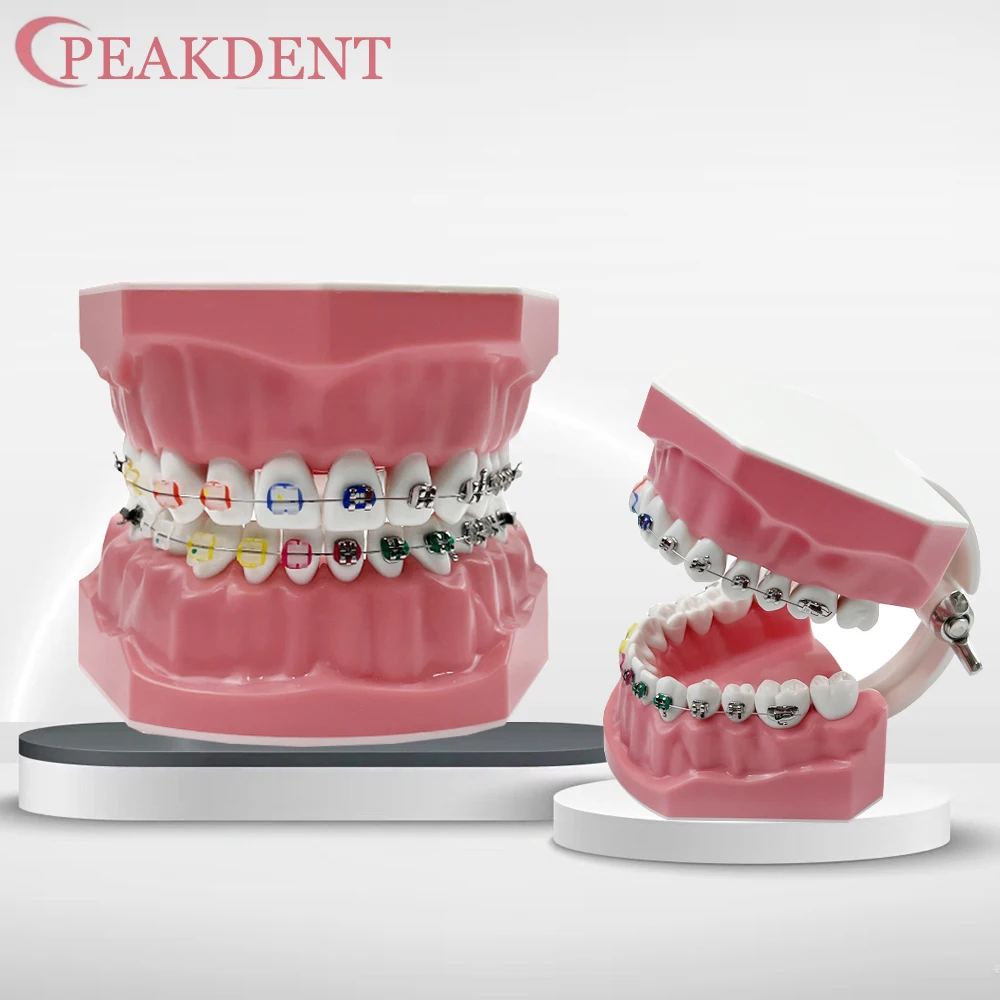 

Orthodontic Teeth Model With Self Ligating Metal Bracket Ceramic Braces Typodont Demonstration Tools For Patient Communication