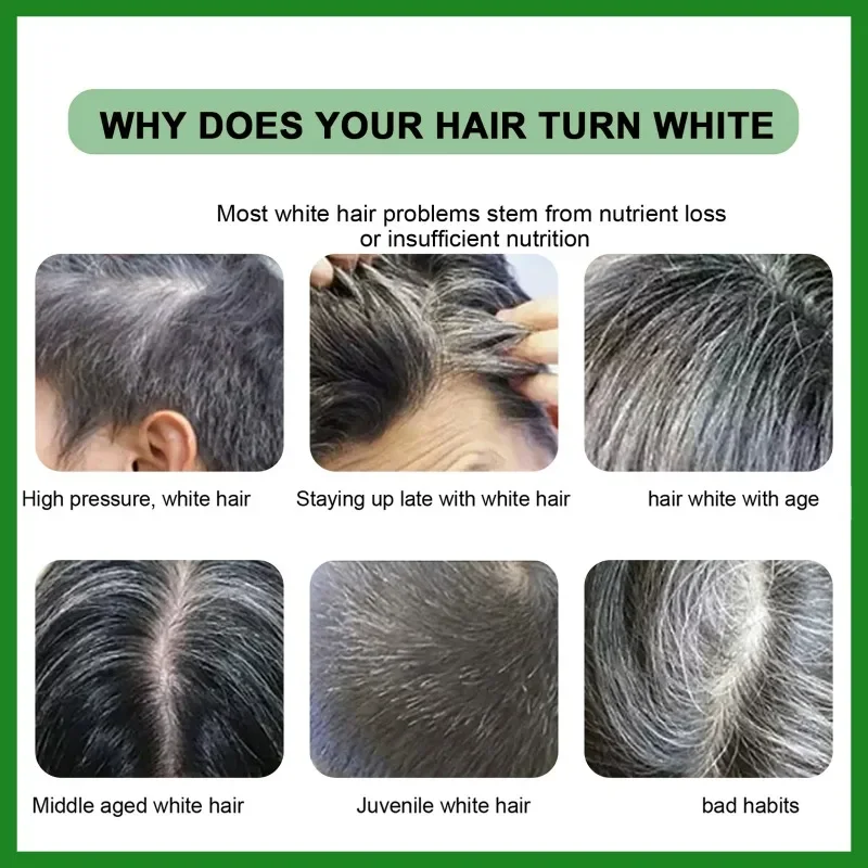 Gray White Hair Treatment Serum Liquid White To Black Natural Color Repair Nourishessence Anti-gray Anti Loss Care