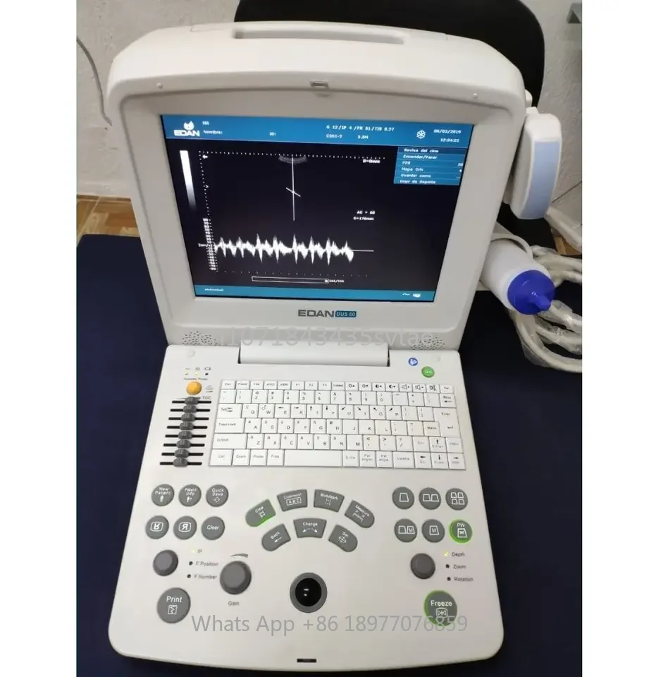 EDAN DUS60 Ultrasound Machine Bdomen Blood Vessels Muscles USG Machine Black And White