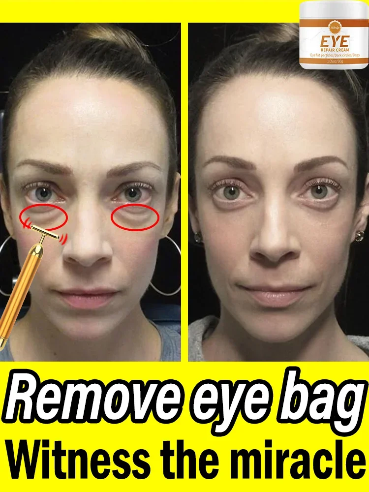 Electronic eye bag removal portable female beauty care