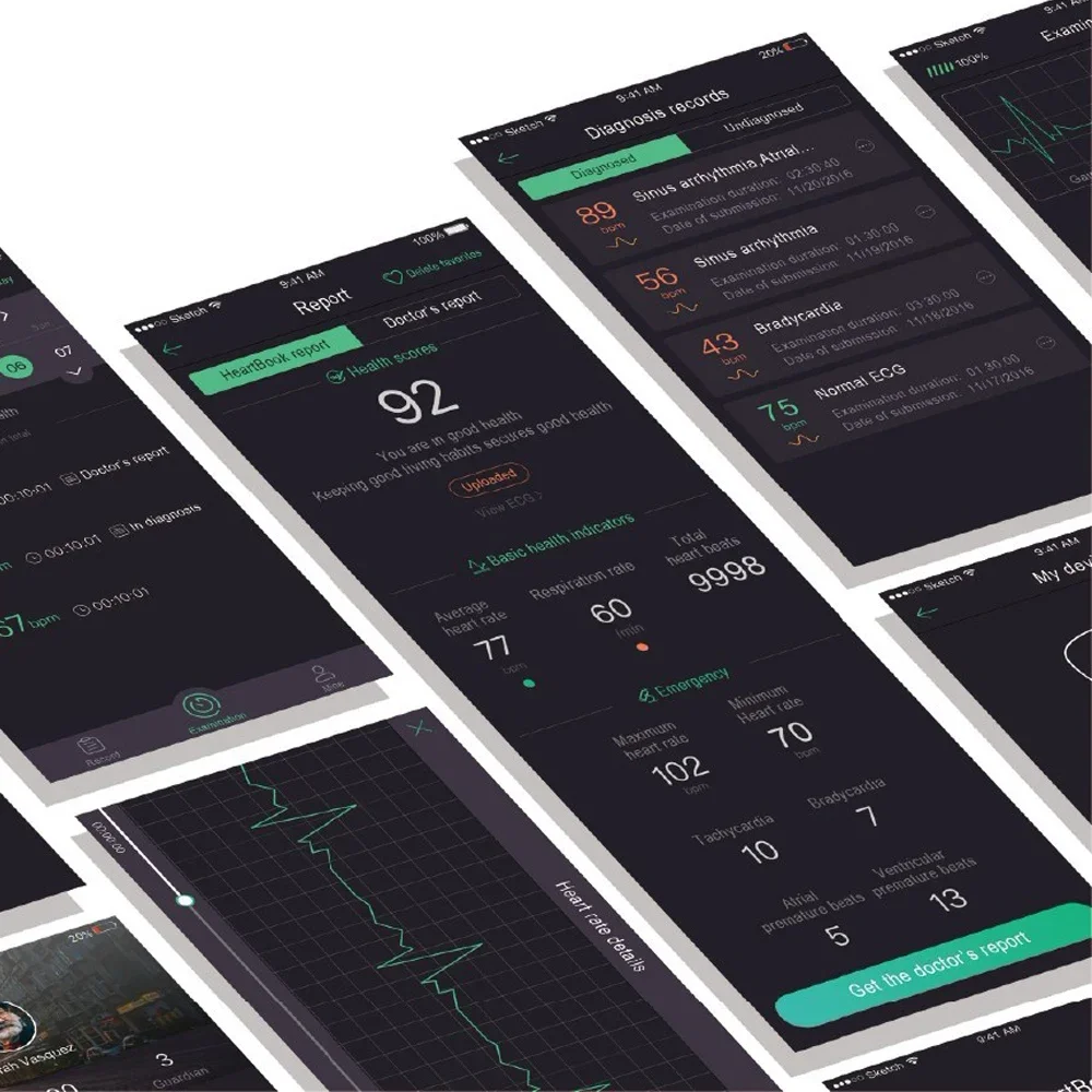 Wireless Holter ECG Wearable ECG Monitoring Chargeable EKG Portable Heart Rate Monitor Arrhythmias Warning PDF Data Report