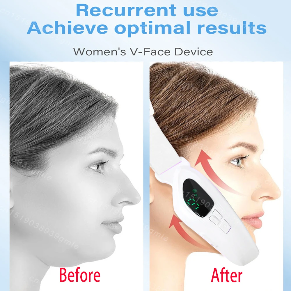 Microstroom Gezichtsmassager Dubbele Kin Verwijdering V-vormige Gezicht Spierstimulator Anti-Rimpel Lift Huid Schoonheid Apparaat Huidverzorging